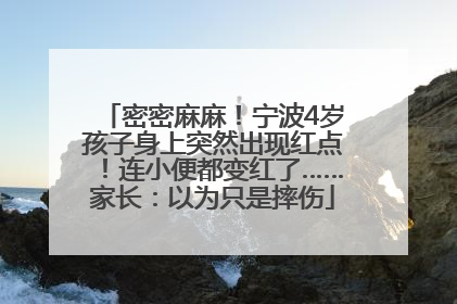 密密麻麻！宁波4岁孩子身上突然出现红点！连小便都变红了……家长：以为只是摔伤